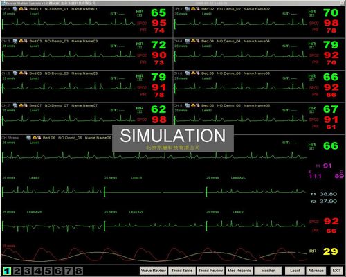 système de contrôle central de moniteur patient de chevet portatif